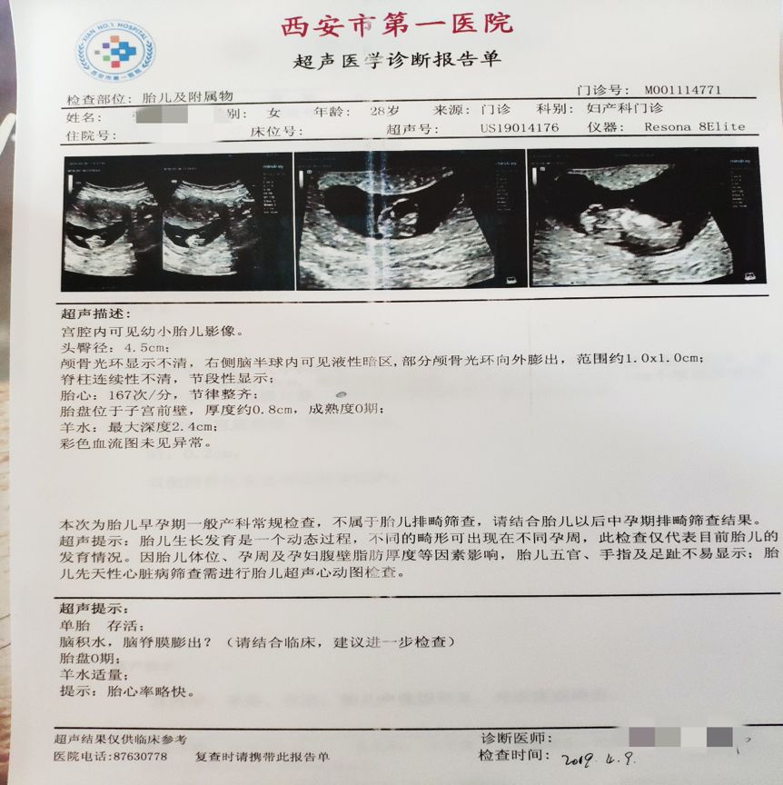 腹中胎儿畸形，要不要堕胎?